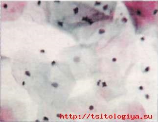 Caracteristici cytologice