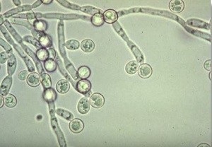 Yeast fungus simptome Candida la femei, bărbați și copii, întrebați un dermatolog