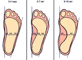 Forma piciorului și a arcului piciorului copilului