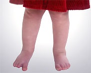 Forma piciorului și a arcului piciorului copilului