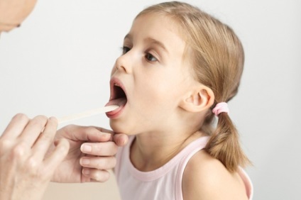 Herpesul în gât în ​​tratamentul și complicațiile copiilor
