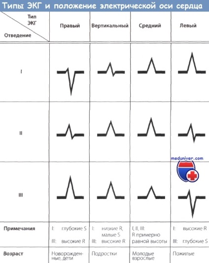 Intervalul r-r, q-t pe eq