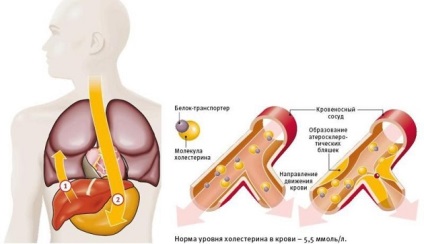 Cum de a reduce colesterolul în stilul de viață al sângelui și nutriția adecvată