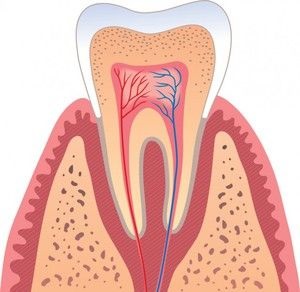 Cum arată nervul dentar și cum să-l ucidă acasă, o ilustrare detaliată a procesului și