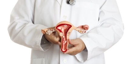 Chisturile endocervixului pe colul uterin, ls