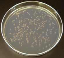Bacterii coliforme