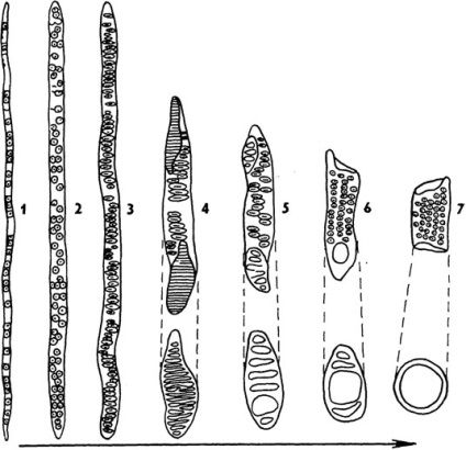 Xylem (дърво)