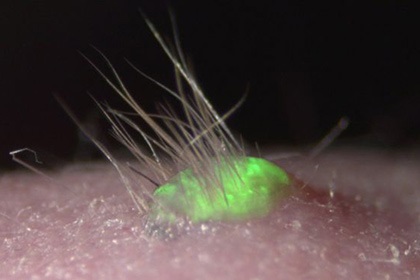Pe pielea artificială, pentru prima dată părul a crescut știința științei și tehnologia