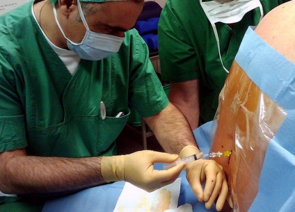 Az anesztézia a mellékvese-gyulladással - az anesztézia appendectis eltávolítása alatt