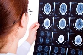 Az agyi keringés tüneteinek és kezelésének megsértése