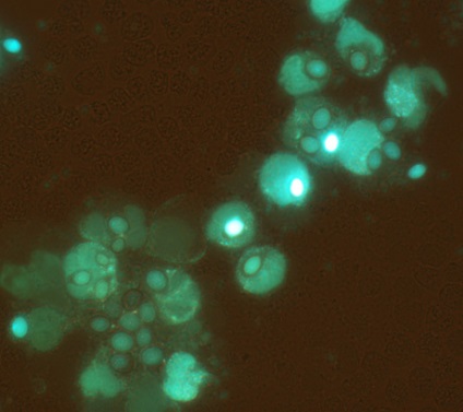 Neutrofile mici, dar luminoase de viață - moitumago