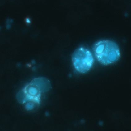 Neutrofile mici, dar luminoase de viață - moitumago