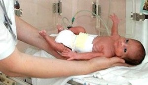 Noua etică a uciderii nou-născuților sau a avortului postnatal, Belarus Sondaj