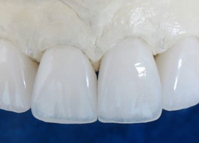 Tehnologii noi de implantare dentară