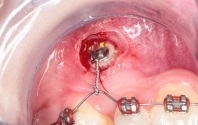 Ortodonție, companie dentară 