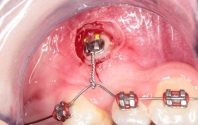 Ortodonție, companie dentară 