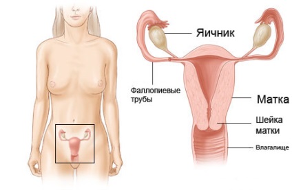 Cancerul uterului - simptome, cauze