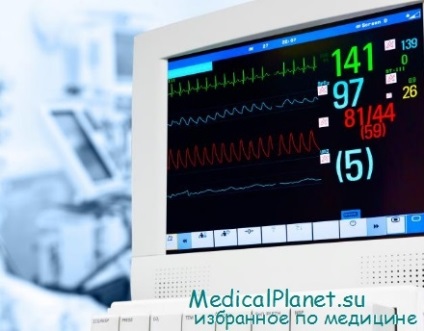 Ruptură de inimă cu infarct miocardic - clinică, diagnostic