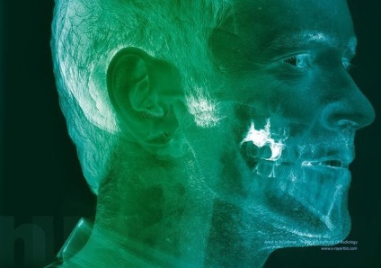 Röntgensugár, amely másképp néz az emberi testre - a tények világának fényképét