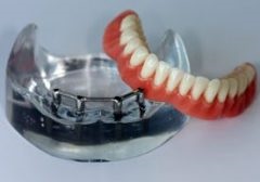 Stomatologie kliomed - ce trebuie făcut dacă proteza dentară