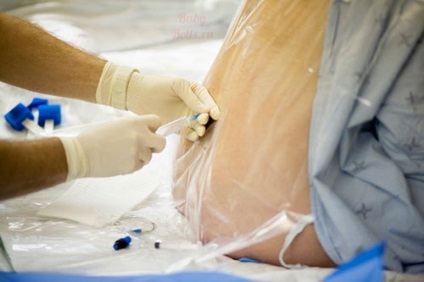 Contracțiile la fiecare 5 minute prin câte nașteri, în timpul travaliului