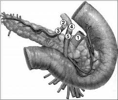 Transplantul de pancreas