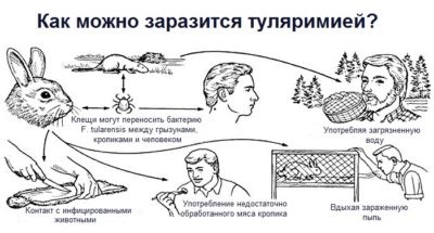 Tularemia este ceea ce este, simptomele la om