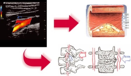 Ултразвуково изследване (ехография, Доплер) кръвоносните съдове, артерии, вени на главата, шията, краката, цена (себестойност), срещи