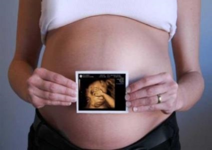 Uzi în timpul sarcinii în marin și în bratislava, uzi fetus în juvao