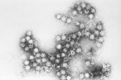 Infecția cu enterovirus de virusul Coxsacki la copii