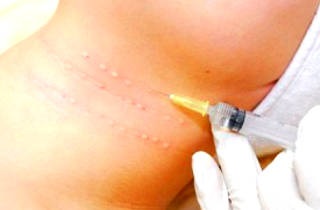 Dăunătorile cu botox la nivelul corpului uman - cu atât sunt mai periculoase