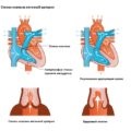 Boala cardiacă congenitală
