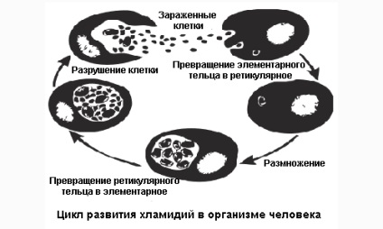 Chlamydia la bărbați semne, complicații și tratament