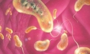 Cholera - cauze, simptome și tratament