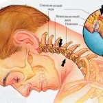 Simptomele estrasistului ventricular