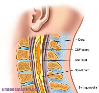 Aimis Clinica de Chirurgie Spinală din Israel