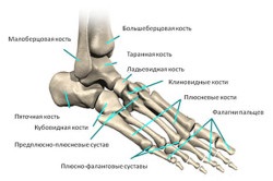Oasele metatarsiale ale piciorului doare