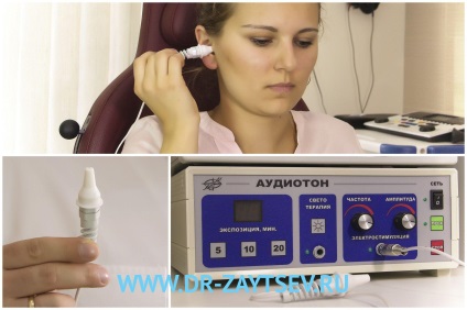 Prețul serviciilor de tratare a auzului prin acțiunea electropulsului în combinație cu laserul cu infraroșu