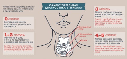 Gusa difuza a simptomelor glandei tiroide si diagnostic corect