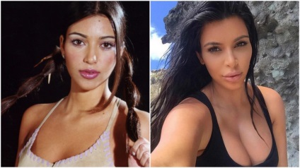 Fotografiile cu celebrități înainte și după plastic vor fi surprinse
