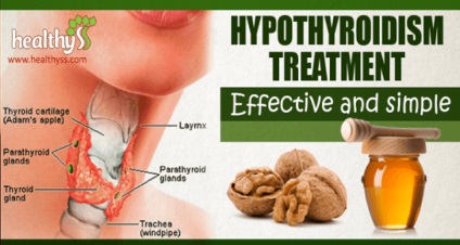 Tratamentul eficient al hipotiroidismului