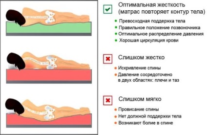 Hogyan válasszunk ortopéd matracot a gerincvelővel