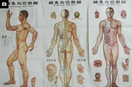 Acupunctura chineza scutita de durere sau nonsens cu ace