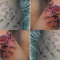 Tetoválás korrekciója a Szabadságban