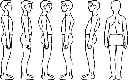Criterii pentru postura normală