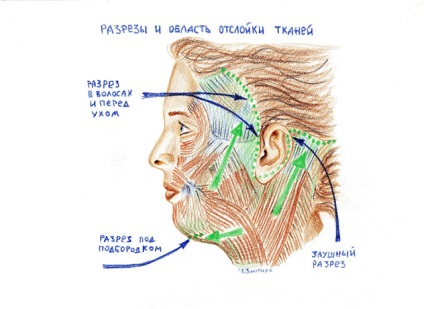 Circulară facelift este una dintre cele mai populare proceduri