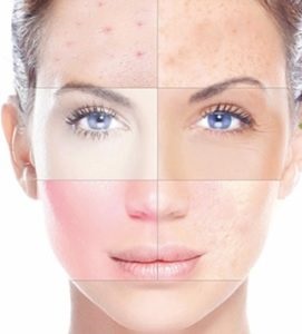 Refacerea pielii cu laser facial în medicină și cosmetologie