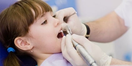 Tratamentul pulpitei dinților infantile în metodele și prețurile copiilor