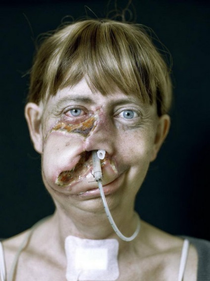 Az arcátültetett emberek erőteljes fotográfiai sorozata