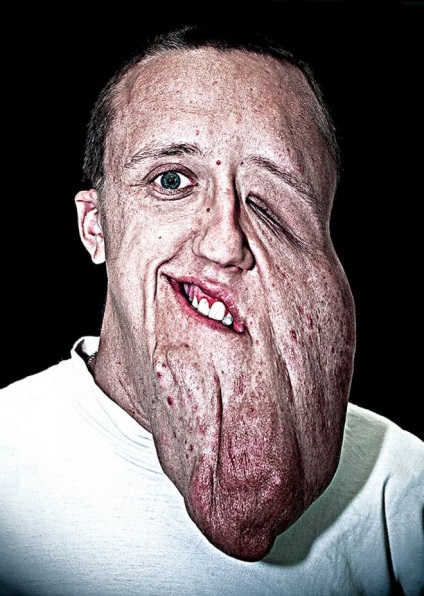 O serie puternică de fotografii ale persoanelor cu transplant de fețe